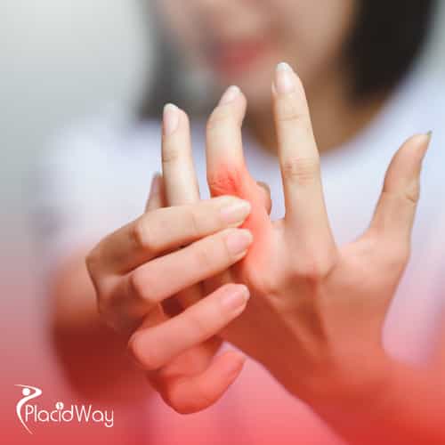 Stem Cell Therapy for Rheumatoid Arthritis in Turkey: A UK Patient's Guide to Treatment